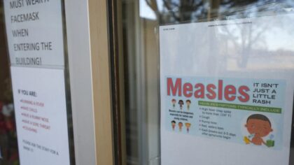 Were you exposed? Whatcom County Health Department issues measles alert